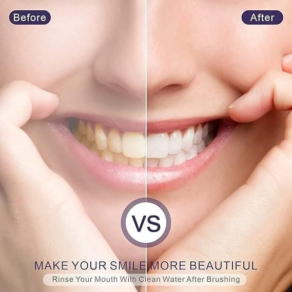 Smilekit V34®️CORRECTTOR DE DIENTES AMARILLOS