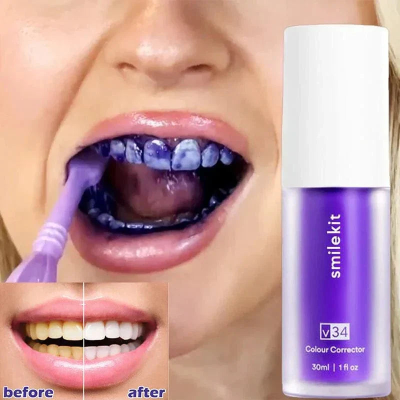 Smilekit V34®️CORRECTTOR DE DIENTES AMARILLOS