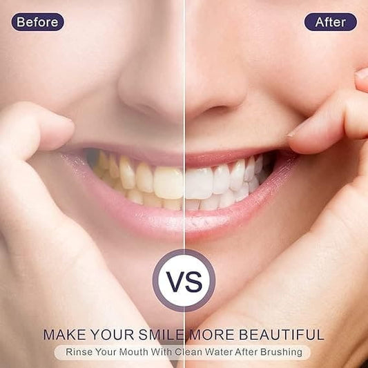Smilekit V34®️CORRECTTOR DE DIENTES AMARILLOS